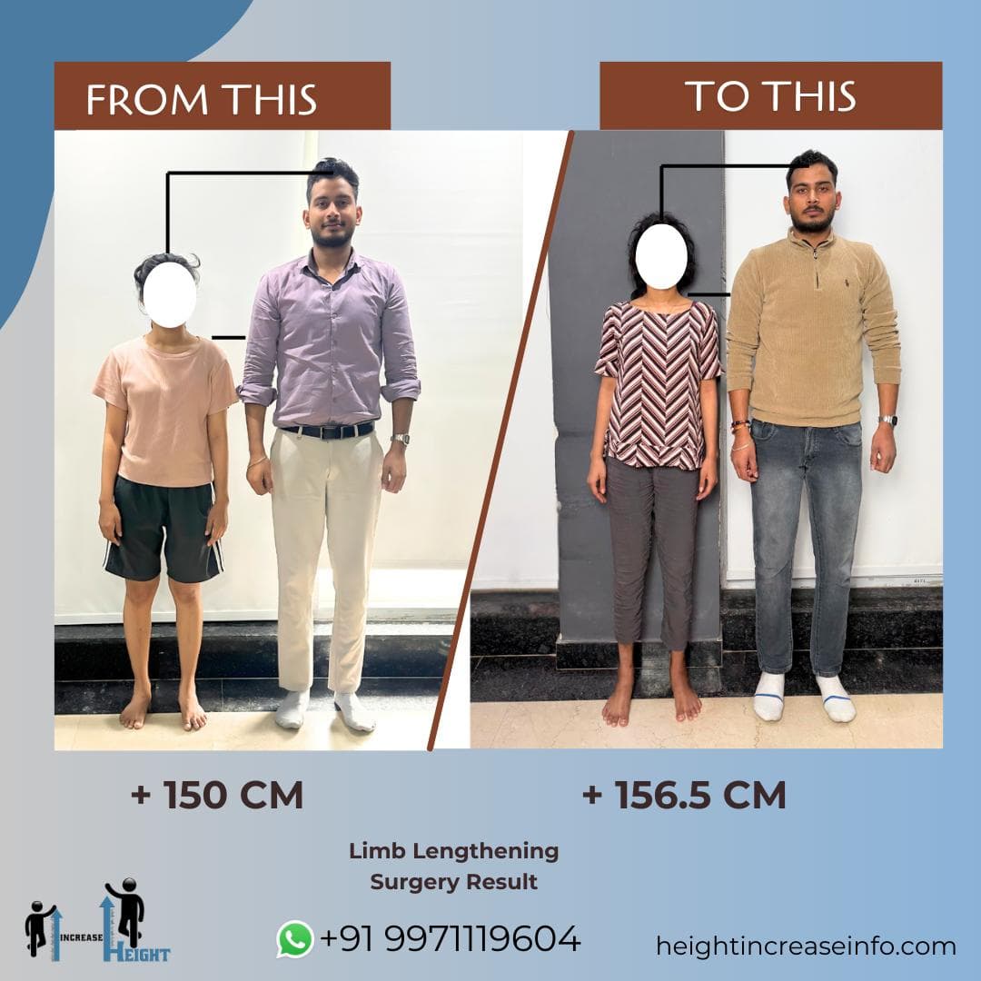 Height Increase Info (Gurgaon) — Limb Lengthening Clinic