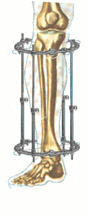 Cosmetic Center for Legs Lengthening & Legs Shape Correction (rucosm.com)